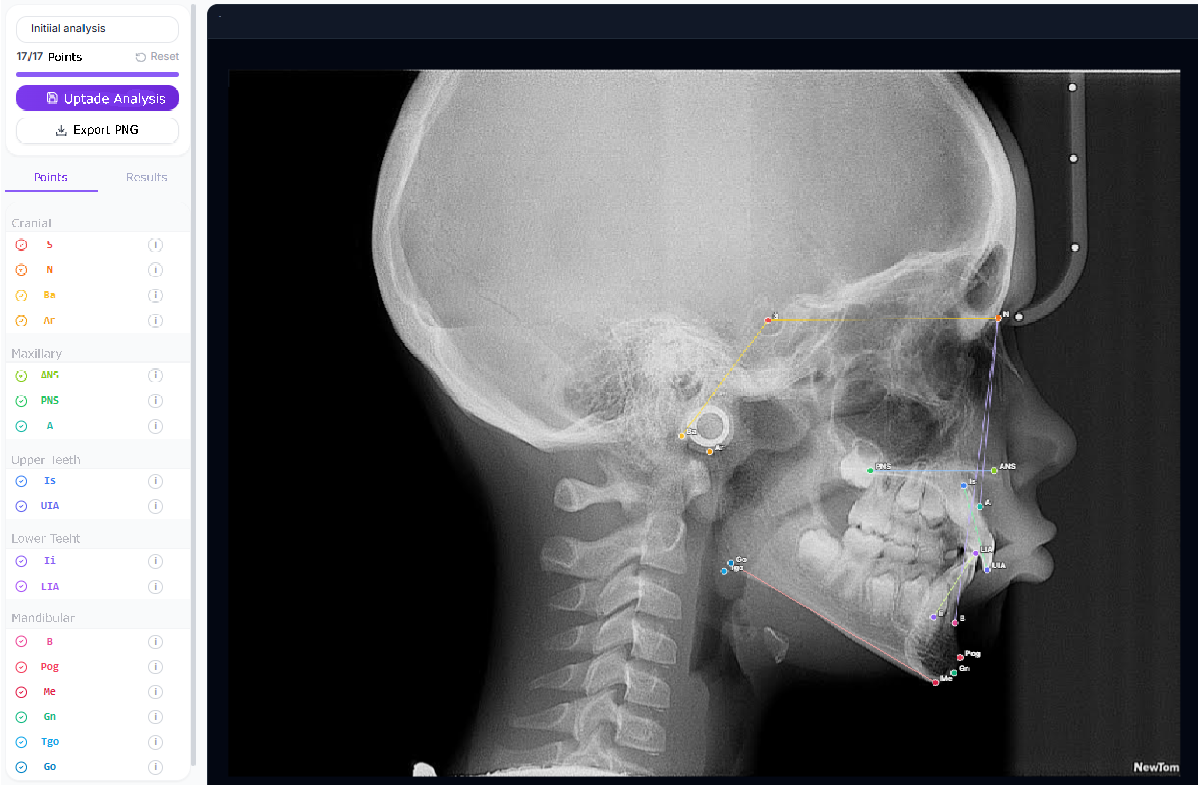 Cefalometria DentalFlow